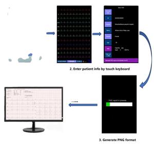 Draagbare <span class=keywords><strong>Ecg</strong></span> Werkstation <span class=keywords><strong>Pc</strong></span> <span class=keywords><strong>Ecg</strong></span> <span class=keywords><strong>12</strong></span> Kanaals Lood Ekg <span class=keywords><strong>Ecg</strong></span> Machines <span class=keywords><strong>Machine</strong></span> - Product Image 5