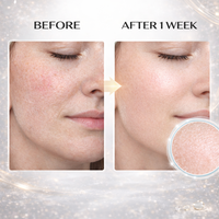 Crème en Capsules PDRN Marque Blanche 100% Niacinamide Éclaircissante pour le Visage, Minimisation des Pores et Réparation
