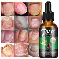 Sérum Traitant les Mycoses des Ongles en 7 Jours, Répare les Dommages des Ongles et des Cuticules, Traite les Champignons, 30ml, Sérum Traitant les Mycoses des Ongles MOOYAM