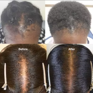 Shampooing Huile de Romarin et Batana Naturelle Anti-Casse et Anti-Fourches, Fortifie les <span class=keywords><strong>Racines</strong></span>, Brillance Naturelle, Marque Privée - Product Image 4