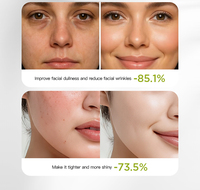 Sérum Facial Combiné en Poudre Lyophilisée Revitalisante aux Polypeptides pour Soins du Visage Anti-Âge et Hydratation – Fabricant OEM