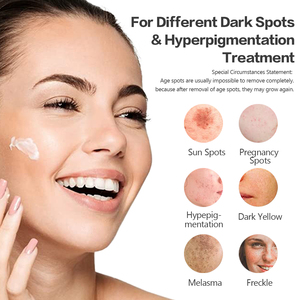 <span class=keywords><strong>Crema</strong></span> Viso Antimacchie e Antirughe Private Label per Rimozione di Macchie Solari, Lentiggini e Melasma - Disponibile - Product Image 3