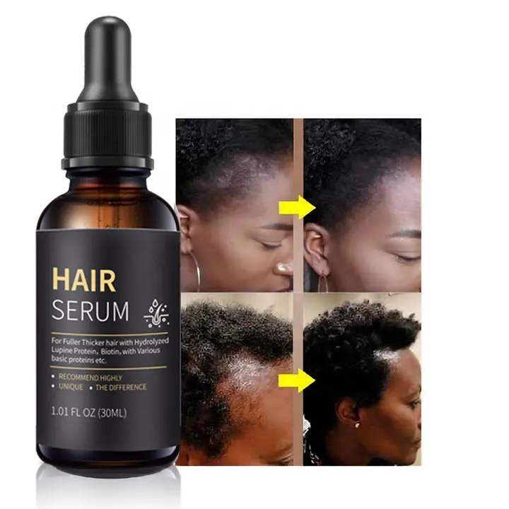 Label pribadi 100% Formula alami grosir nutrisi Vitamin kulit kepala Perawatan Rambut rontok Serum Minyak penumbuh rambut