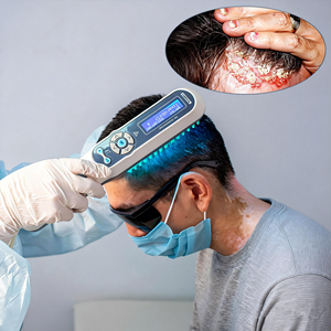 Lámpara de Fototerapia UVB de Grado Médico de 311nm de Kernel Factory, Marca Líder por 29 Años, para Psoriasis, Vitíligo y <span class=keywords><strong>Dermatitis</strong></span> Atópica - Product Image 3