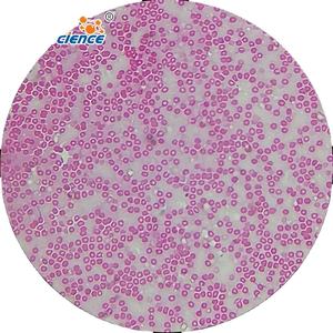 Microscópio preparado slides 18pcs hematologia vidro preparado lâminas esfregaço de sangue - Product Image 1