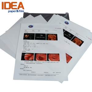 Película Médica de Alta Resolución Blanca para Impresión de Inyección de Tinta, Base PET, para Ultrasonido <span class=keywords><strong>y</strong></span> Endoscopia, Compatible con Impresoras Epson - Product Image 2