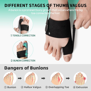 Corrector de <span class=keywords><strong>Juanetes</strong></span> para Mujer y Hombre, Ajustable, de Tela de Nailon, Férula para Hallux Valgus, Alivio del Dolor del Dedo Gordo del Pie, Soporte Diurno y Nocturno (Izquierda/Derecha) - Product Image 3