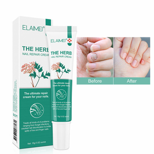 Pomada reparadora nutritiva antiinfección <span class=keywords><strong>de</strong></span> uñas <span class=keywords><strong>de</strong></span> los pies, crema reparadora <span class=keywords><strong>de</strong></span> hierbas antihongos, OEM - Product Image 1