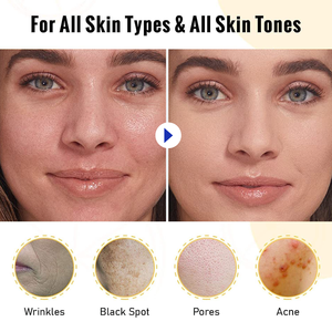 Siero concentrato <span class=keywords><strong>super</strong></span> potente alla vitamina C con nicotinamide, acido ialuronico, acido salicilico e retinolo, tutto in uno, siero illuminante anti-età - Product Image 4