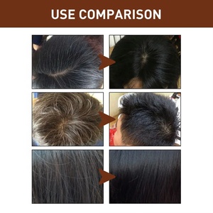 Barre de shampoing solide faite à la main marque privée 2 en 1 pour soins capillaires bio savon solide pour shampoing sans sulfate - Product Image 5