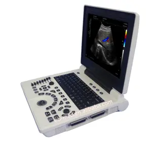 Portable Cheap Digital Color Doppler 3D Laptop Ultrasound Diagnostic Machine With IMT automatic measure function CU26