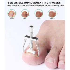Offre Spéciale orteil ongles récupérer outil de Correction en acier inoxydable <span class=keywords><strong>pince</strong></span> à lisser <span class=keywords><strong>ongle</strong></span> incarné ensemble orthopédique pour <span class=keywords><strong>traitement</strong></span> de pédicure - Product Image 4