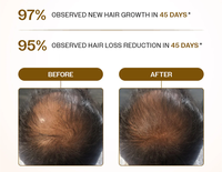 Serum Pertumbuhan Rambut Canggih Label Pribadi Roll-on Alami Mengurangi Kerontokan Rambut Merangsang Pertumbuhan Kembali Memperkuat Akar Serum Rambut Rosemary