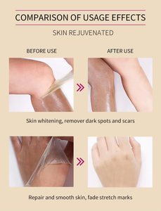 น้ำมันลอกผิวที่ตายแล้วทำให้ผิวขาวขึ้นและนุ่มผิวลอกผิวสีเหลือง - Product Image 6