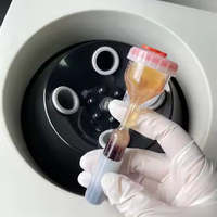 Kit professionnel de plasma riche en plaquettes autologues avec composants en plastique pour le rajeunissement de la peau et la croissance des cheveux