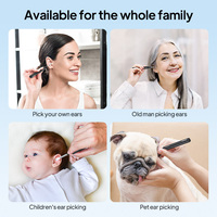 Precio de Liquidación: Otoscopio Soulear WiFi 5MP con Luz LED para Limpieza de Cera de Oídos