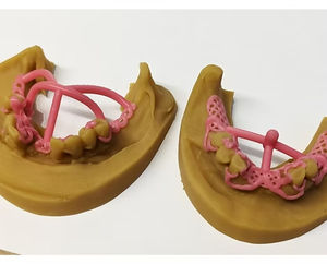 Resina Dental BlueCast para Impresora 3D LCD, 0.5 kg, Precisión Extrema, Estabilidad Dimensional, Italia - Product Image 2