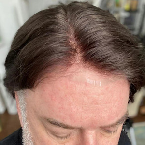 Tous les cheveux humains système de remplacement de cheveux hommes toupet remplacement de cheveux hommes toupet peau mince, pas cher postiche toupet perruques hommes - Product Image 1