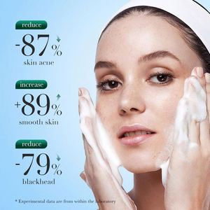 OEM SADOER Private Label Tea <strong>Tree</strong> <strong>Face</strong> Wash Organic Deep Clean Removing Acne Oil Control Moisturizing Whitening Facial Cleanser - Product Image 5
