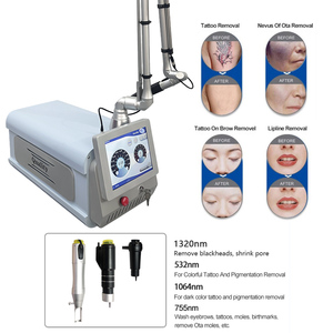 Máquina Láser de Picosegundos Portátil para Eliminación de Tatuajes, Rejuvenecimiento de la Piel, Eliminación de Pigmentos y Pecas, con Certificación CE - Product Image 3