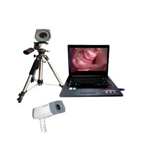 <span class=keywords><strong>Colposcope</strong></span> Video resolusi tinggi untuk pemeriksaan serviks akurat - Product Image 1