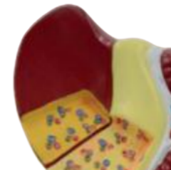 ADA-A754B PVC y tế giải phẫu mô hình giáo dục 2-phần bệnh gan mô hình lý thuyết cho giảng dạy - Product Image 2