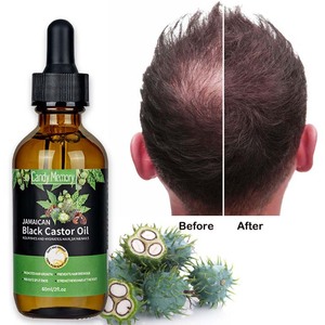 Huile de ricin noire biologique de la Jamaïque Huile de ricin naturelle pure en vrac pressée à froid pour les cils, les <span class=keywords><strong>sourcils</strong></span> et la croissance des cheveux - Product Image 1