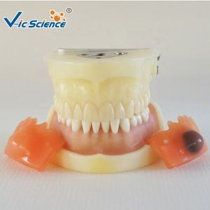 Modèle de dents dentaires d'enseignement médical pour la pratique de la coupe de <span class=keywords><strong>kyste</strong></span> - Product Image 3