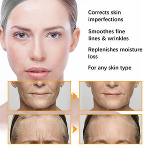 Genç Ciltler İçin Zerdeçal Gliserinli Yüz Kremi Gündüz Beyazlatıcı Aydınlatıcı Kırışıklık Karşıtı Yaşlanma Karşıtı Tüm Cilt Tipleri İçin Güvenli Sonsuza Kadar Özel - Product Image 6