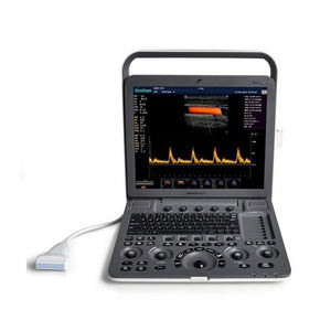 Sonoscape S8 Exp Draagbare Kleur Doppler Echografie Voor Veterinaire Dieren Handheld Veterinaire Echografie Machine - Product Image 1