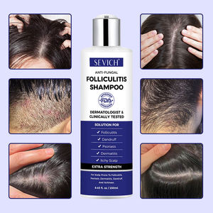 Shampoo per capelli con <span class=keywords><strong>pidocchi</strong></span> antiforfora con acido salicilico e follicolite Shampoo trattamento per la cura dei capelli del cuoio capelluto - Product Image 1
