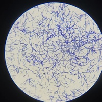 Microbiology Prepared Microscope Slides Set Bacteria Fungi Specimen Slides for Medical University Biological Laboratory Teaching