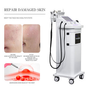 Dispositivo Multifuncional 11 en 1 para el Cuidado <span class=keywords><strong>Facial</strong></span> con Oxígeno Portátil, Limpieza con Chorro de Agua, Exfoliación, Reducción de Poros, Blanqueamiento, Eliminación de Acné - Product Image 4