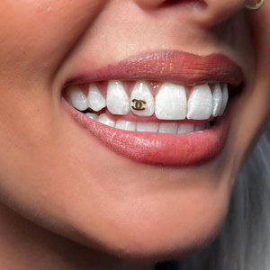 Kit professionnel de bijoux dentaires, formes géométriques variées, plaqué or 18 carats et options lumineuses, préféré par les dentistes - Product Image 4