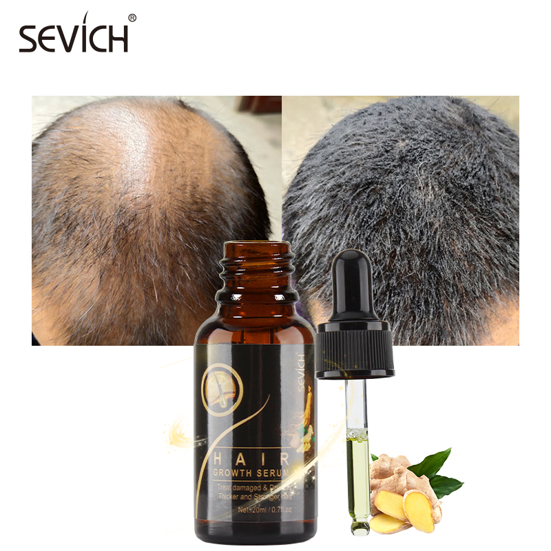 Новое поступление, сглаживающая восстанавливающая против выпадения, восстанавливающая кожу головы эликсир, фирменная масляная Сыворотка для роста волос
