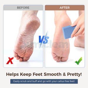 Herramienta de <span class=keywords><strong>Limpieza</strong></span> <span class=keywords><strong>para</strong></span> Pies, <span class=keywords><strong>Piedra</strong></span> Pómez <span class=keywords><strong>para</strong></span> Exfoliar y Eliminar Piel Dura, Herramienta <span class=keywords><strong>para</strong></span> Limpiar la Piel de los Pies, <span class=keywords><strong>Piedra</strong></span> Pómez <span class=keywords><strong>para</strong></span> Eliminar Piel Muerta - Product Image 5