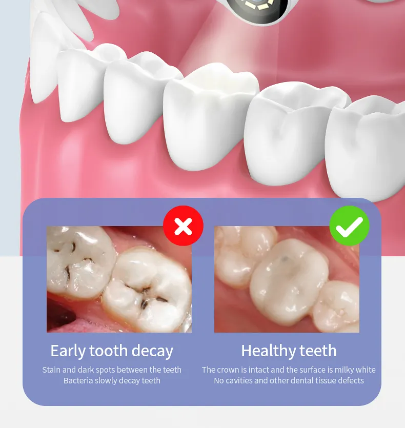 SINBOL 비주얼 껌 공급 업체 맞춤형 기계식 De Dientes 휴대용 여행 전기 음파 칫솔 카메라