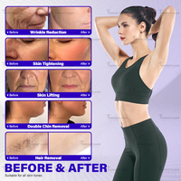 Perfectlaser OPT 5 longueurs d'onde, machine de beauté laser multifonctionnelle pour l'acné, la pigmentation, les vaisseaux sanguins, le rajeunissement de la peau, spa