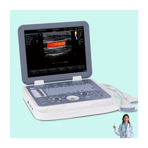 Ecografo Doppler a Colori Portatile LCD da 15 Pollici per Esami Ginecologici e Ostetrici Umani e Veterinari - Product Image 1