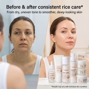 Kit de Soins <span class=keywords><strong>Visage</strong></span> Bio <span class=keywords><strong>Hydratant</strong></span> et Éclaircissant pour Femmes Noires – Gamme de Produits Naturels au Riz pour une <span class=keywords><strong>Peau</strong></span> Éclatante (Marque Blanche) - Product Image 3