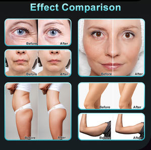 Agente exclusivo 8 manijas S Body Shaping 40K 80K Cavitslim Vacuum 8in1 Pérdida de grasa Cuerpo Adelgazamiento Máquina de rodillos <span class=keywords><strong>Precio</strong></span> para la cara - Product Image 6