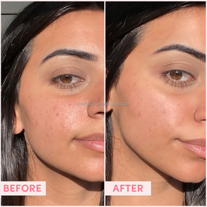 Marque privée OEM ODM <span class=keywords><strong>Gommage</strong></span> exfoliant à l'argile rose, matifiant et revigorant pour éclaircir le visage - Product Image 4