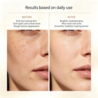 Lance Marque privée Sérum à la vitamine C Vente en gros Cible Taches foncées Correction des imperfections Éclat pour la peau Coffret de sérum à la vitamine C pour le visage