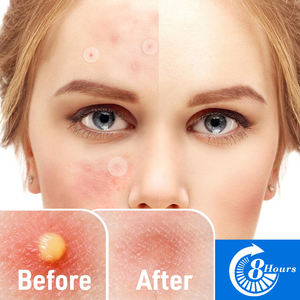 Onzichtbare Acne Puistje <span class=keywords><strong>Patch</strong></span> Hydrocolloïde <span class=keywords><strong>Patch</strong></span> Fr Acne Zorgplek Genezende Pleisters - Product Image 5