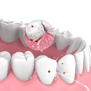 Super Mini IPX7 getto d'acqua pick filo interdentale irrigatore orale portatile colore acqua filo filo per bretelle - Product Image 4