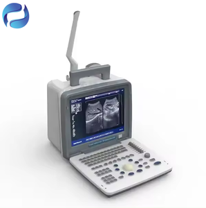 Portable Veterinary <strong>Ultrasound</strong> Scanner Medical Diagnostic <strong>Ultrasound</strong> Scanner with Key Accessories - Product Image 5
