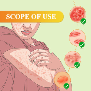 Оптовая продажа, 20 г, крем для лечения псориаза кожи - Product Image 6