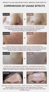 Nuovissima Maschera LED a 7 Colori per Trattamento Anti-Età e Acne, Ringiovanimento della Pelle, Terapia della Luce LED, Massaggiatore Facciale - Product Image 6