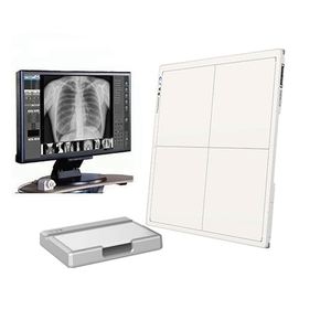 Detector DE RAYOS X de panel plano DR eléctrico con sistema CR Tecnología Digital IRAY Equipos y accesorios de radiología - Product Image 1