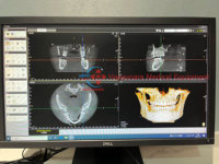Appareil de radiographie panoramique dentaire électrique 3D PAPAYA Plus Pano Ceph CBCT d'occasion